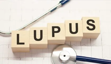 Lupus