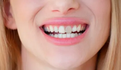 mancha negra en el diente