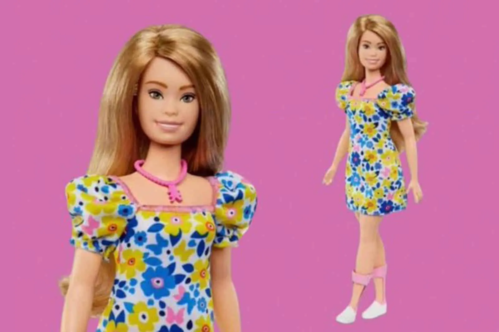 Barbie síndrome de Down
