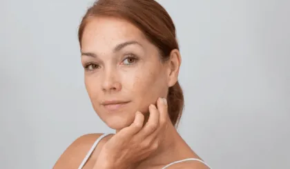 manchas oscuras en la piel