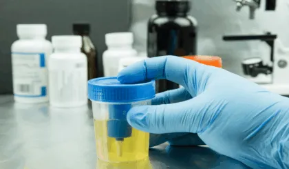 enfermedades que se detectan con una prueba de orina