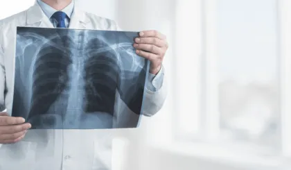 malformación en el tórax