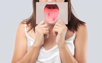 El color de tu lengua puede decir mucho sobre tu salud