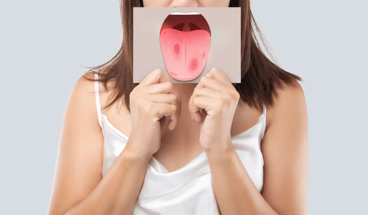 El color de tu lengua puede decir mucho sobre tu salud