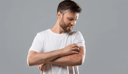 psoriasis grave aumenta el riesgo cardiaco