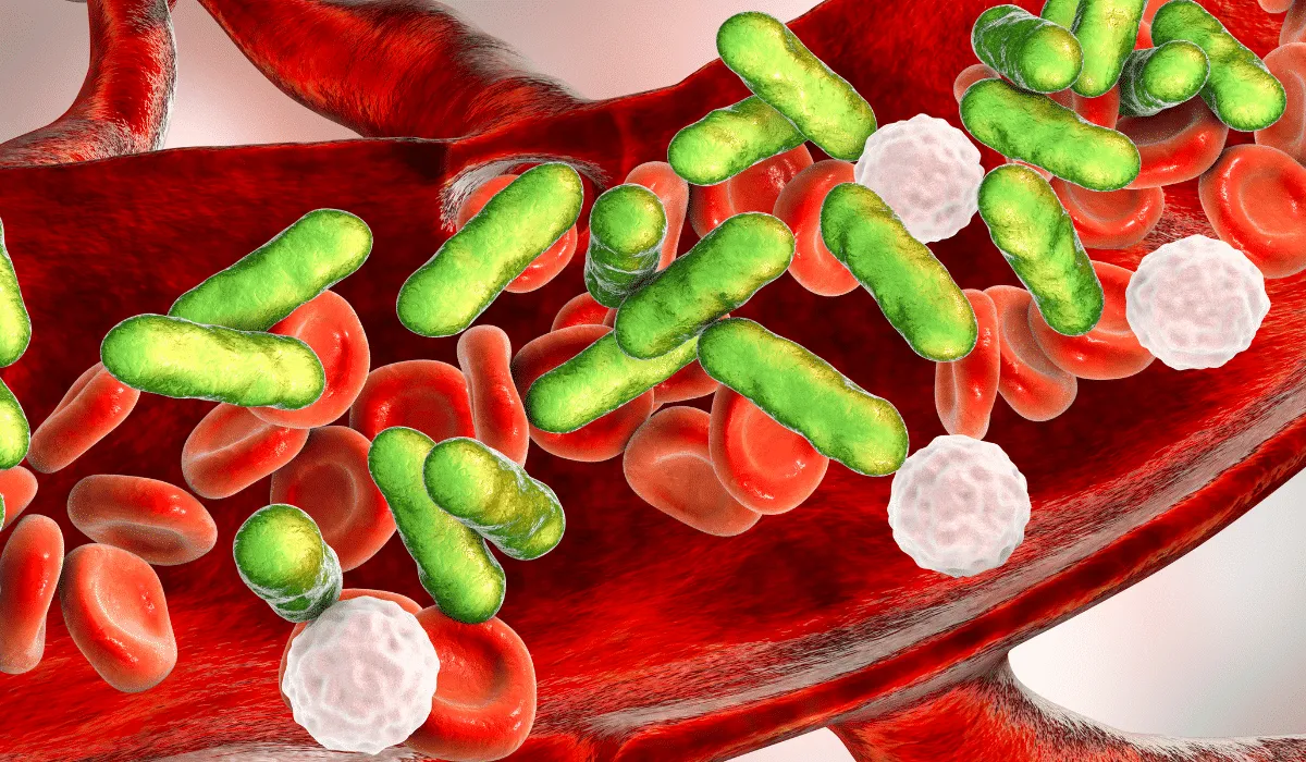 qué es la sepsis