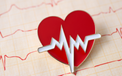 arritmia cardíaca y accidente cerebrovascular