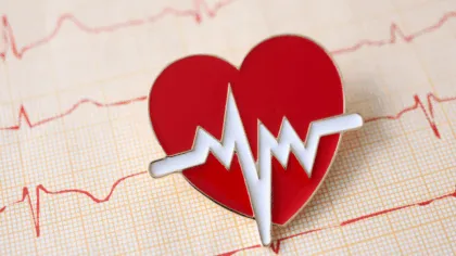 arritmia cardíaca y accidente cerebrovascular