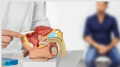 cáncer de próstata