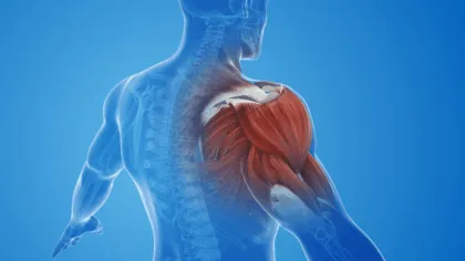 4 señales de que tienes un desequilibrio muscular