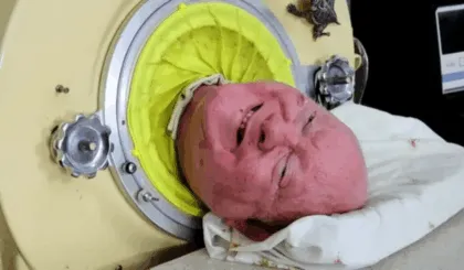 Muere el hombre del pulmón de acero Paul Alexander