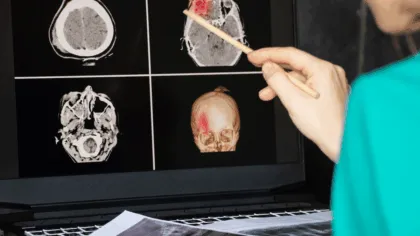 larvas de tenia en el cerebro