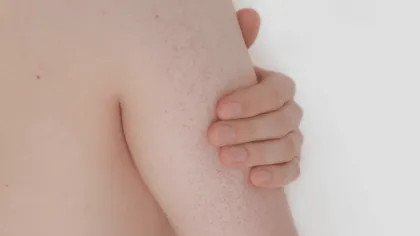 ¿Cómo combatir la piel de gallina ?