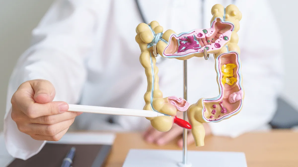 Cancer colorrectal