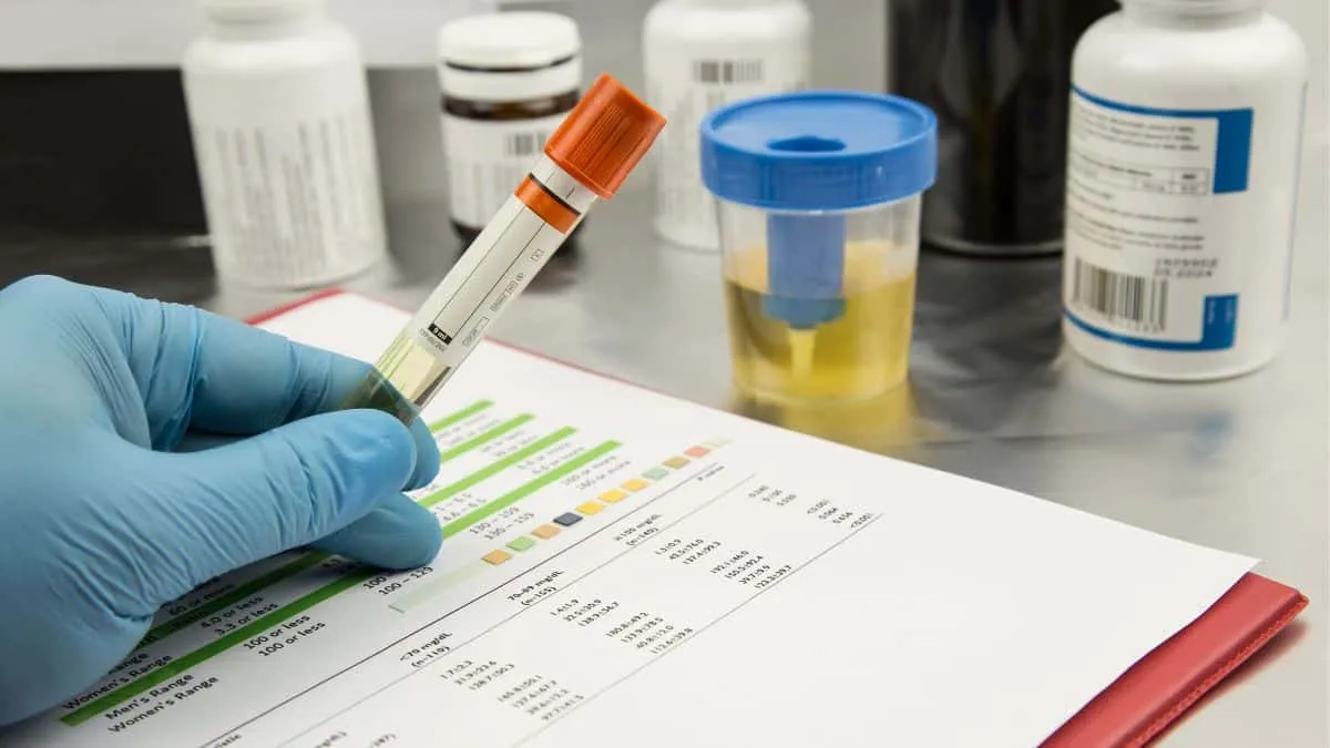 Una prueba de orina podría detectar cáncer