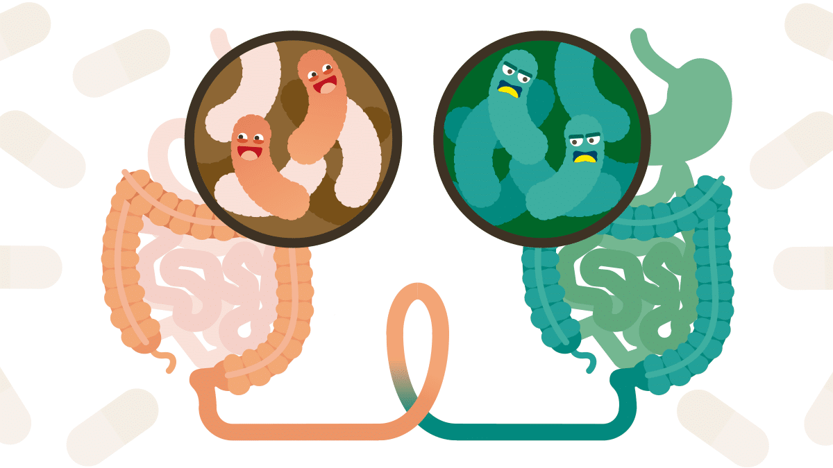 Descubre qué es el trasplante de microbiota fecal y cómo puede mejorar tu salud intestinal.