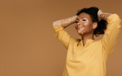 Normalizacion del vitiligo tarea pendiente