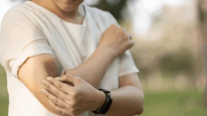 Te aparecen moretones sin pegarte