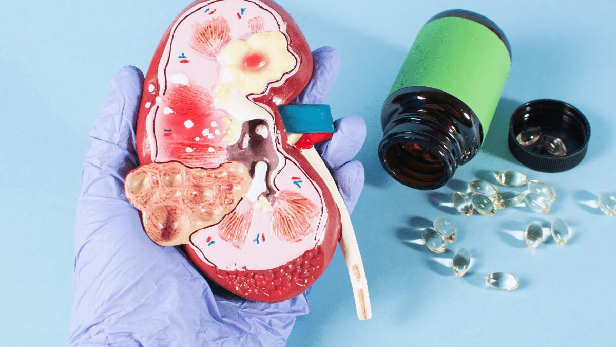 Dieta y enfermedad renal: Cómo aliviar los síntomas según los expertos