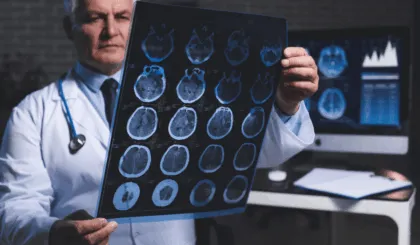 Con solo un neurólogo por cada 72,000 habitantes, México enfrenta una grave crisis en la atención neurológica. Descubre las causas y soluciones.