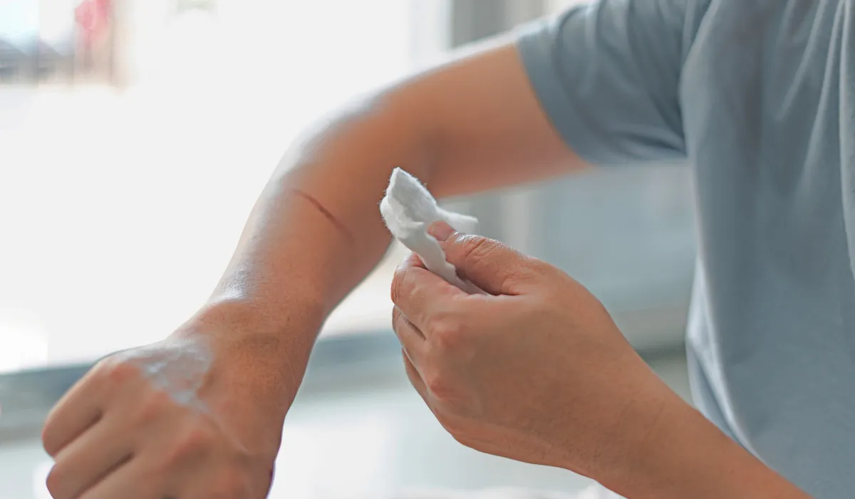 Ni alcohol ni agua oxigenada Esto es lo que realmente cura heridas