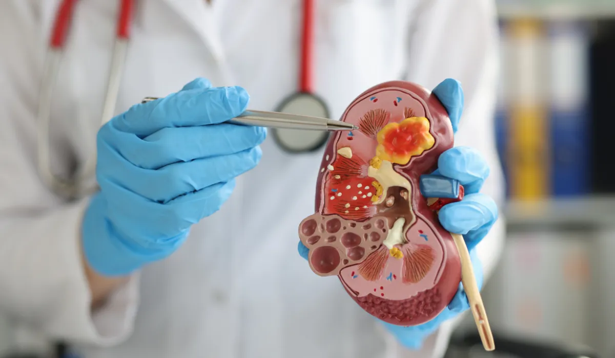 Sabías que estos 3 alimentos de consumo diario pueden dañar tus riñones