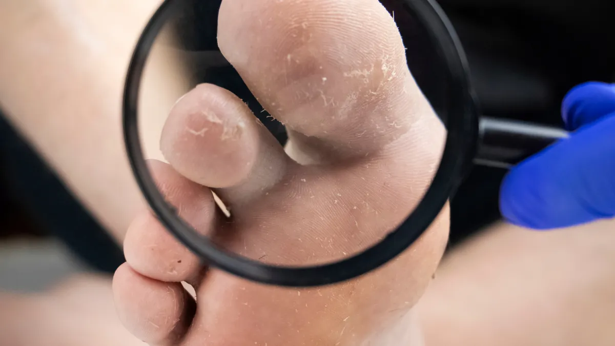 enfermedad que tus pies pueden revelar