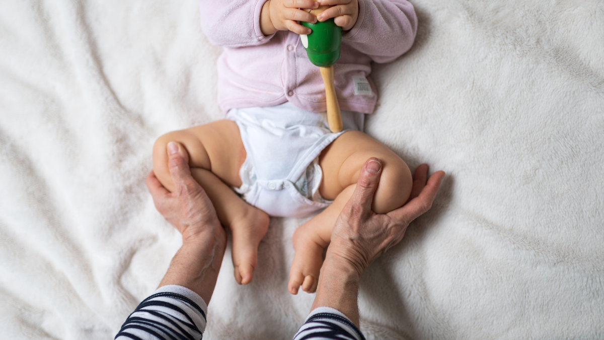 ¿Qué es la displasia de cadera y por qué es un problema prioritario de salud en mujeres?