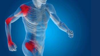dolor articular cuerpo