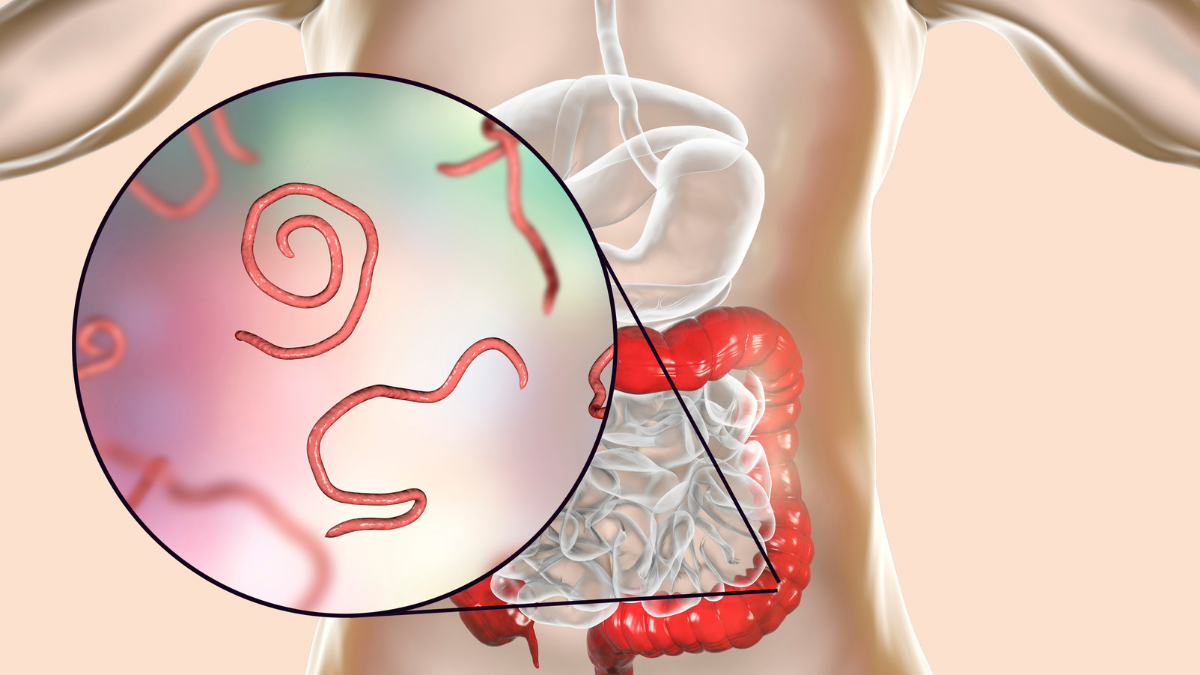 Cómo los gusanos intestinales podrían frenar la obesidad y la diabetes tipo 2