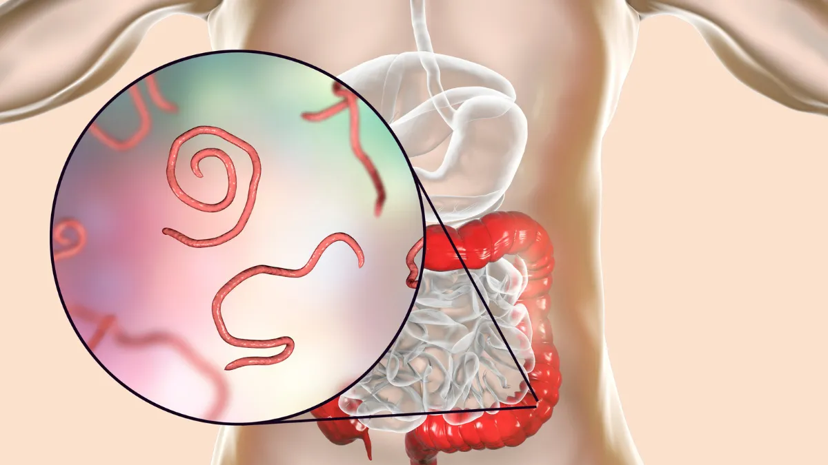 Gusanos intestinales