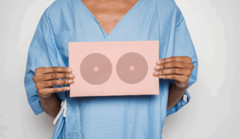 microplásticos y cáncer de mama