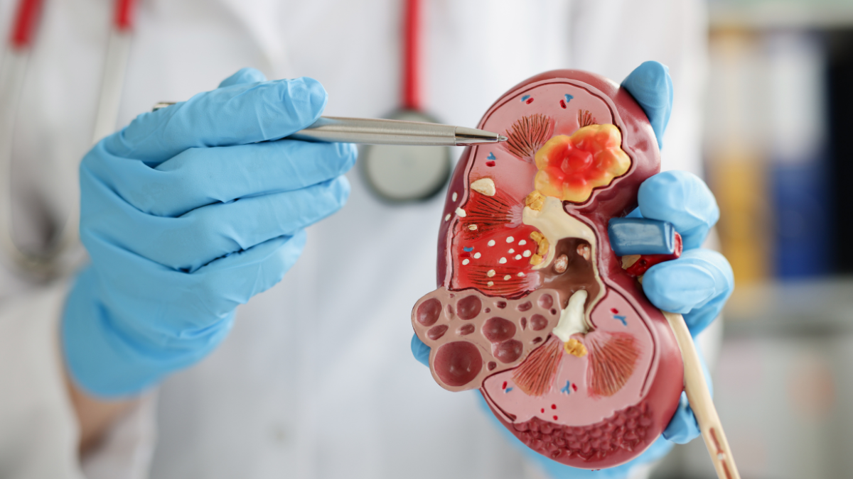 ¿Tomas ibuprofeno y omeprazol con frecuencia? Esto debes saber sobre tu salud renal