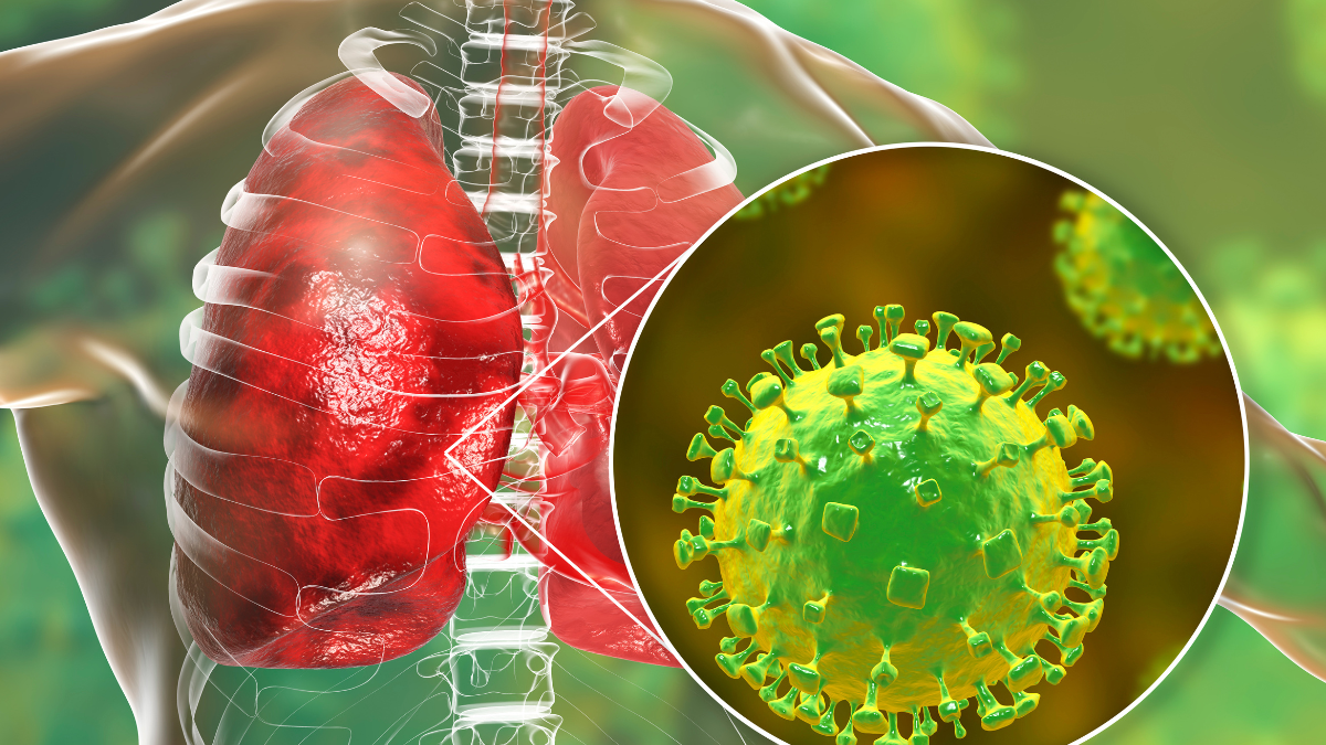 Virus Nipah: ¿La próxima amenaza global?