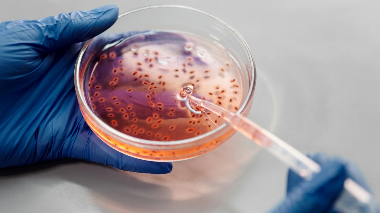 Investigadores descubren evidencia genómica de la bacteria responsable de la peste