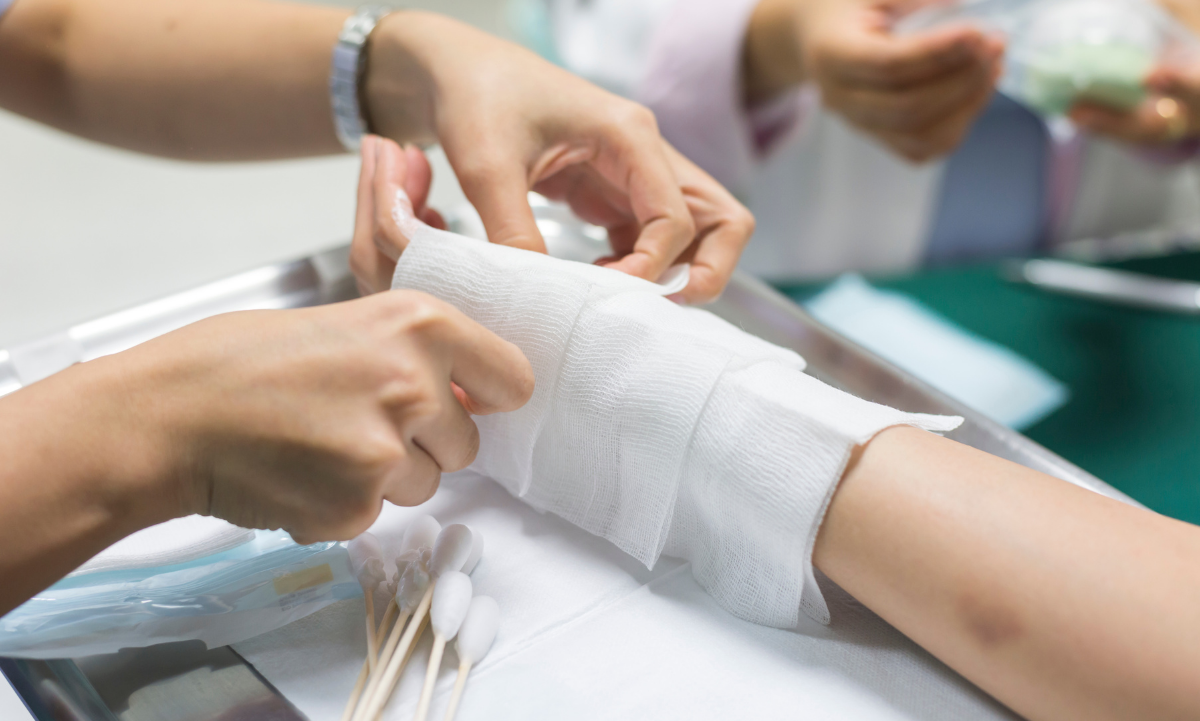 ¿Sabes qué hacer ante quemaduras? Una guía para emergencias