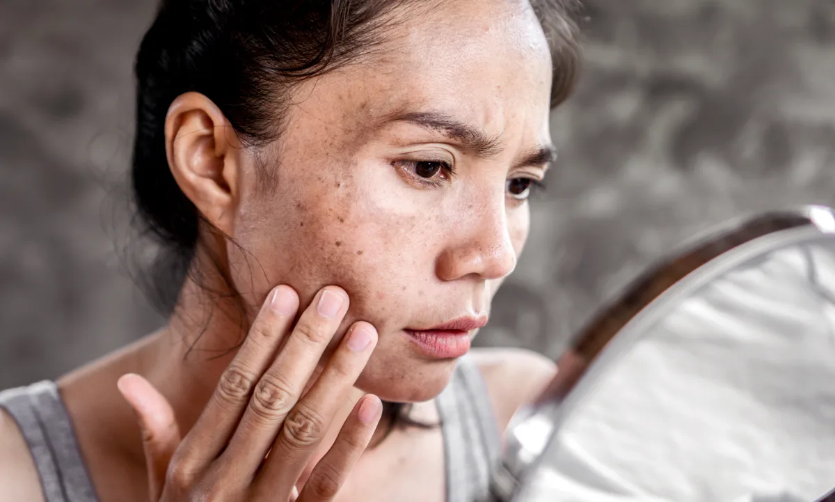 Tu rostro puede ser un mapa de tu salud: 9 señales de enfermedad en la cara