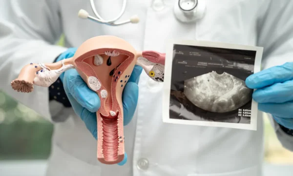 Ovario poliquístico y obesidad: la relación que muchas mujeres desconocen