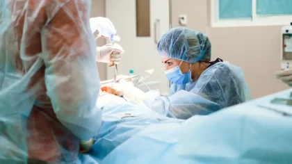 estiramientos faciales