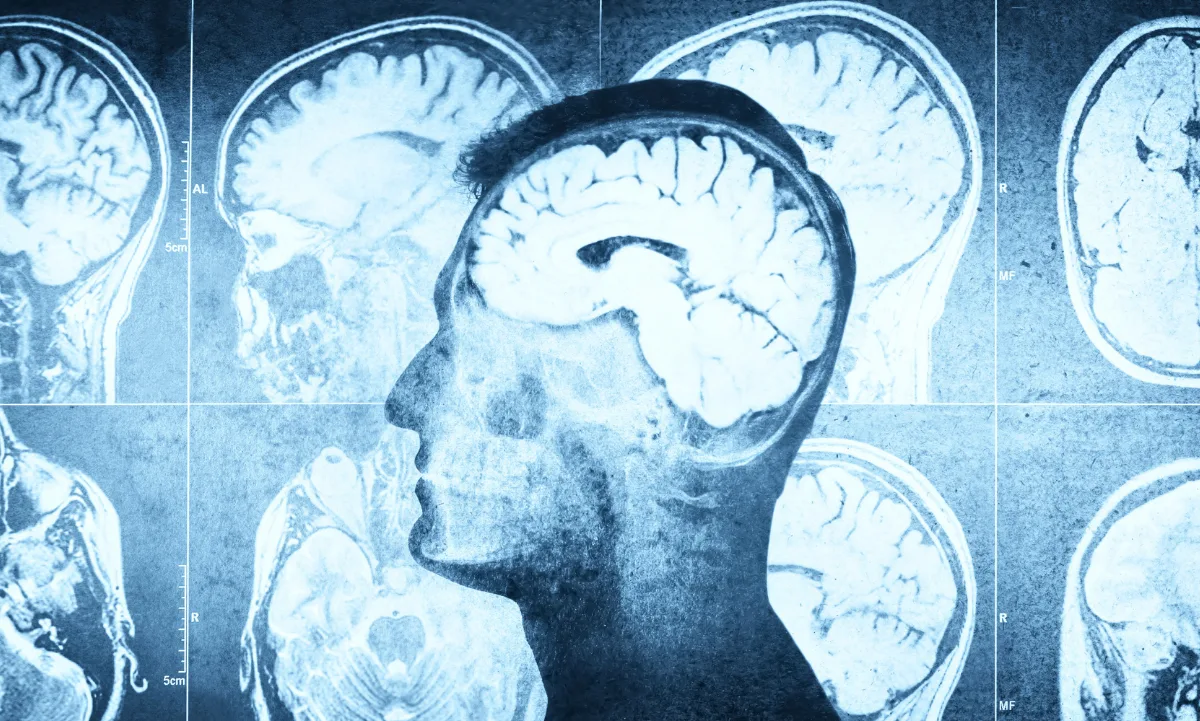 ¡Sorpresa! El plomo moldeó nuestro cerebro y lenguaje, según estudio clave
