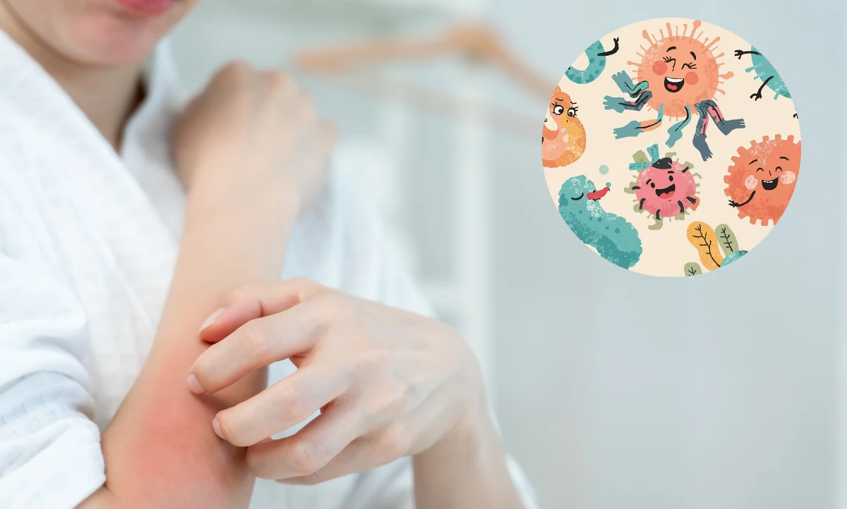 ¿Problemas de acné o psoriasis? Tu intestino podría tener la respuesta