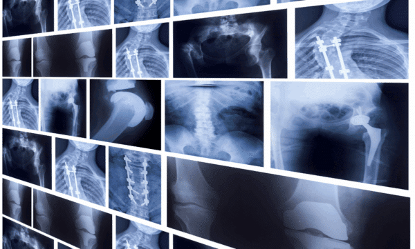 descubrimientos accidentales humanidad