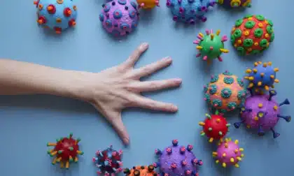 Virus Epstein-Barr y lupus