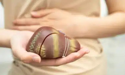 El hígado graso no tiene medicamento, ¡pero sí solución! Estos cinco consejos son clave para recuperar tu salud.