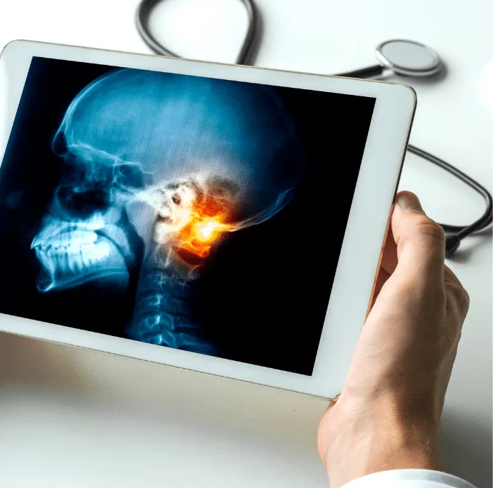 Artículaciones Cabeza y mandíbula