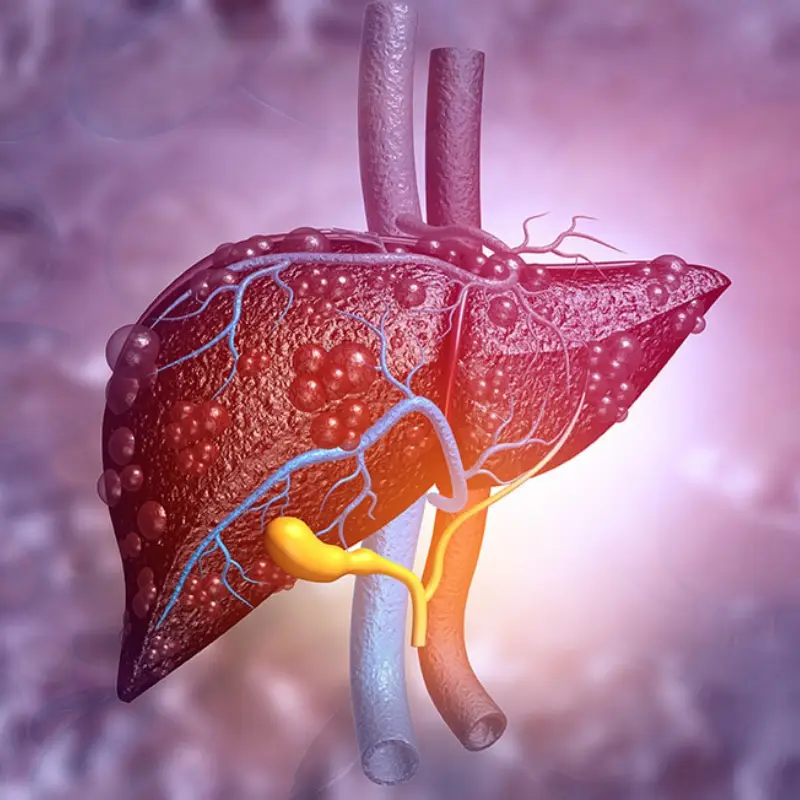 Hepatitis tóxica: qué hierbas y suplementos dañan el hígado y por qué evitarlos
