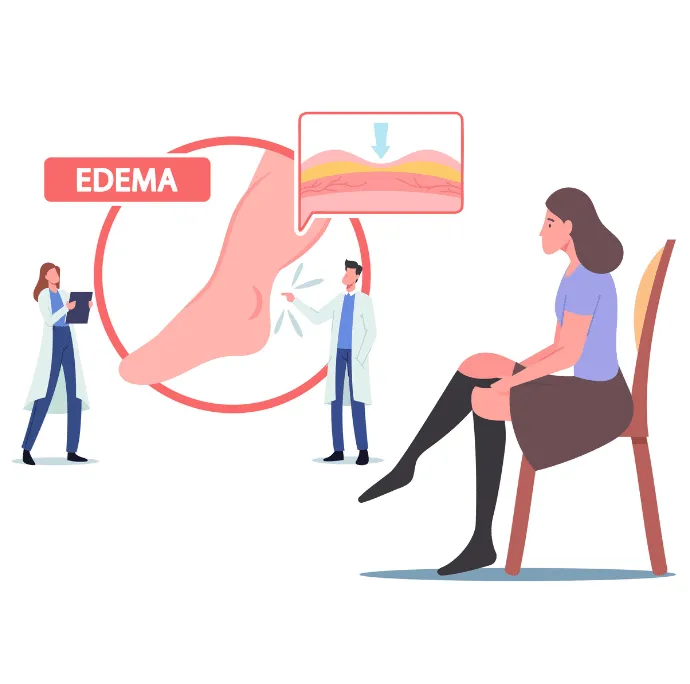 Las causas principales de la retención de líquidos