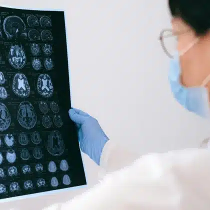 herramienta Alzheimer