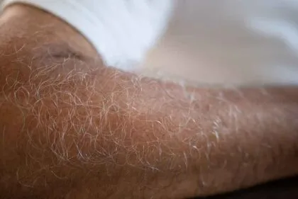 cudiado de la piel en la tercera edad