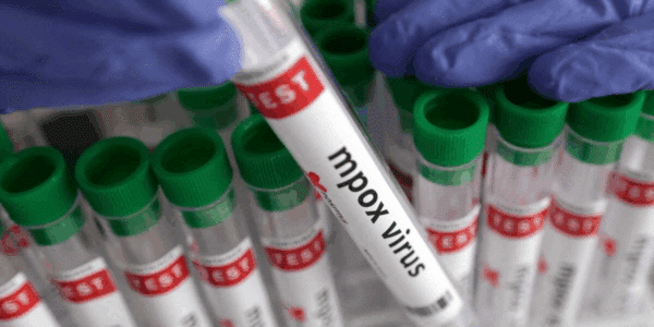 La comunidad científica utiliza el término clado para identificar las ramas principales del Mpox